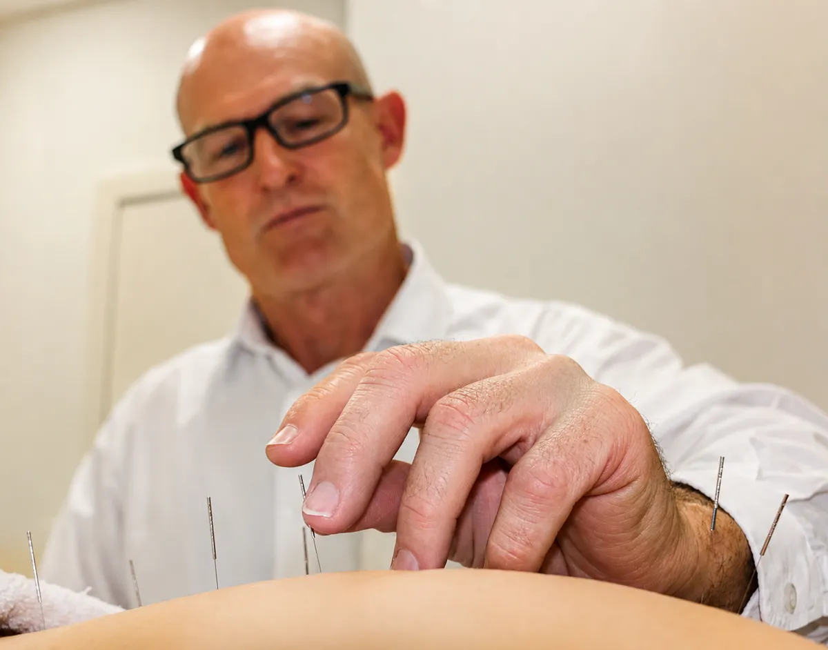 Acupuncture treatment detail at Health Hub Tweed Coast, Hastings Point.